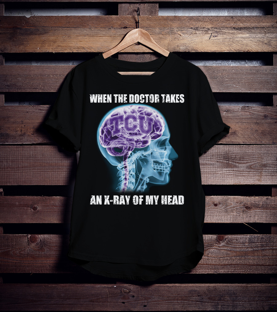TCU Horned Frogs When The Doctor Takes An X-ray Of My Head T-Shirt