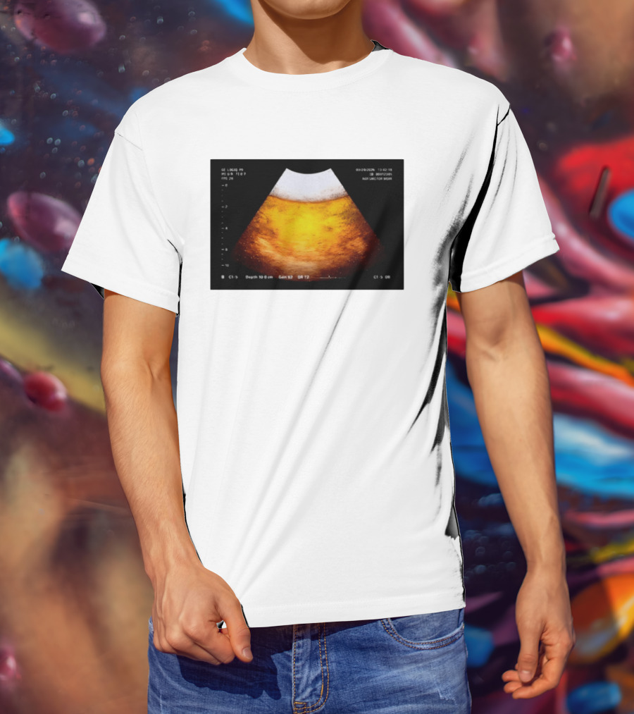 Beer Ultrasound Image Not Safe For Liver T-Shirt