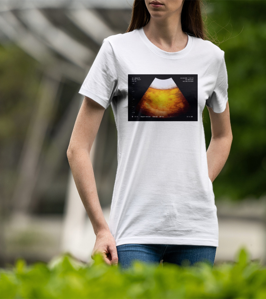 Beer Ultrasound Image Not Safe For Liver T-Shirt
