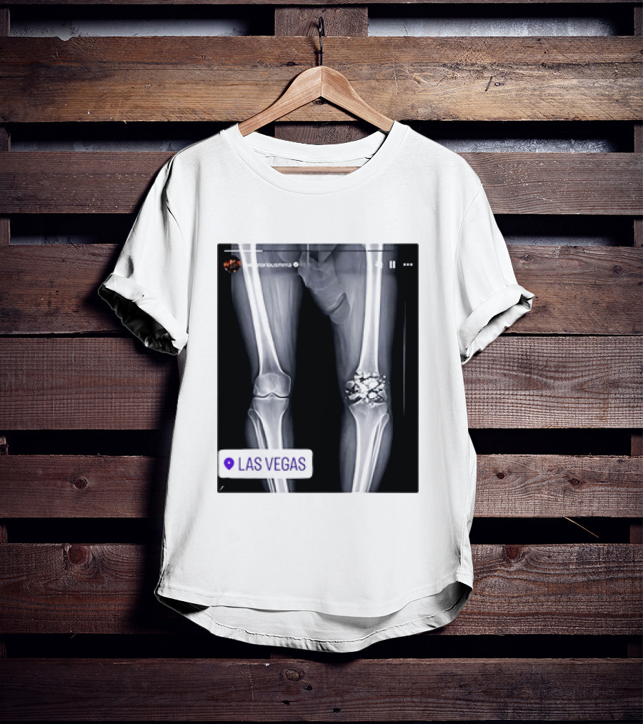 Conor McGregor X Ray Broken Knee Las Vegas T-Shirt