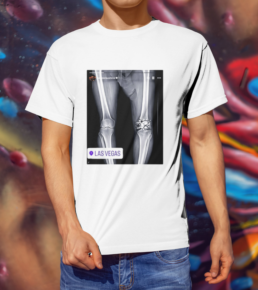 Conor McGregor X Ray Broken Knee Las Vegas T-Shirt